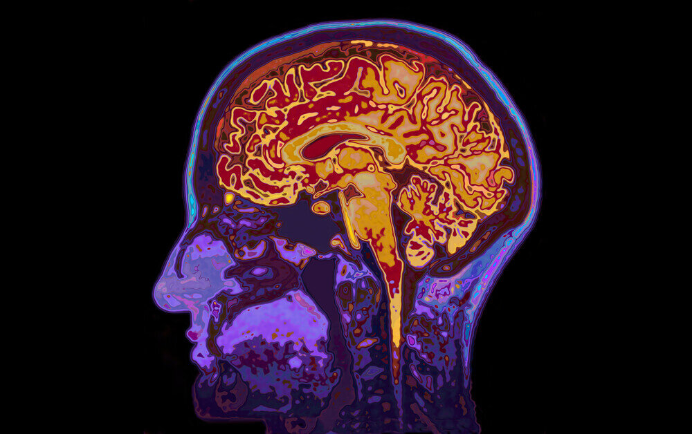 Is Dancing Good for The Brain? Science Says Yes
